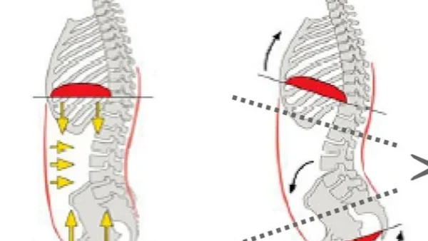 反り腰×ヒップアップの正しい考え方