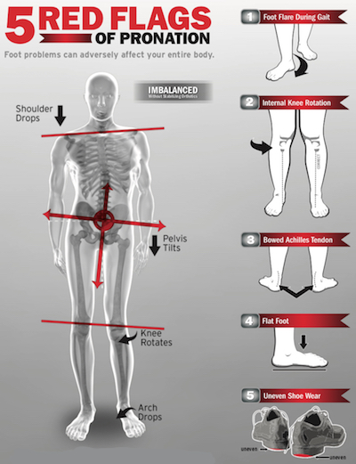 https://healthworkstx.com/wp-content/uploads/2025/10/5_Red_Flags_of_Pronation.jpg